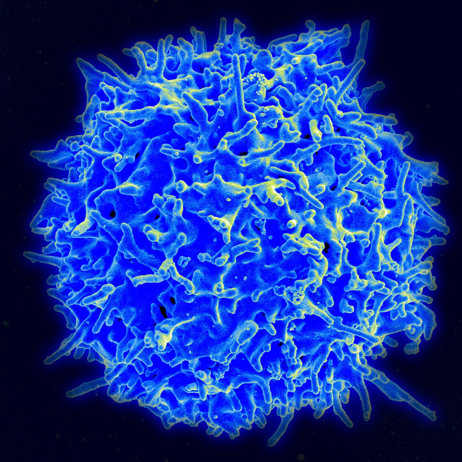 Blue and yellow surface details of a human T cell against a dark background.